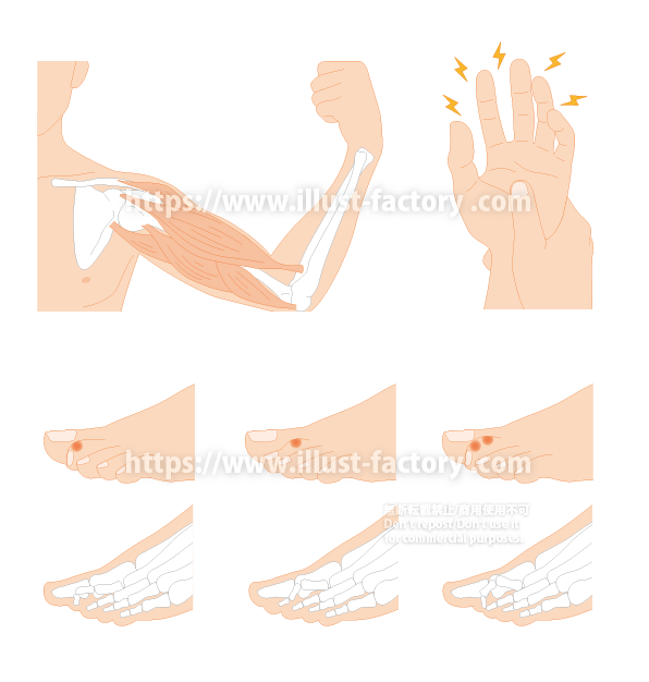 医療イラスト/骨と筋肉のイラスト/論文イラスト/図解