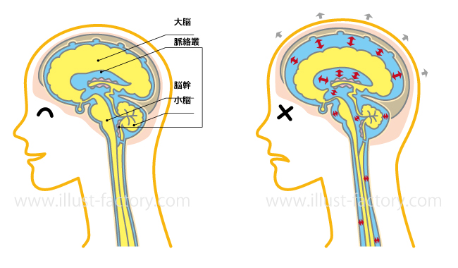 脳の断面 図解イラスト お仕事紹介 質問解決ブログ イラスト制作の株式会社アット