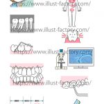 歯のイラスト★優しいイメージで一般の方にわかりやすいタッチ★