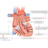 心臓の医療系図解