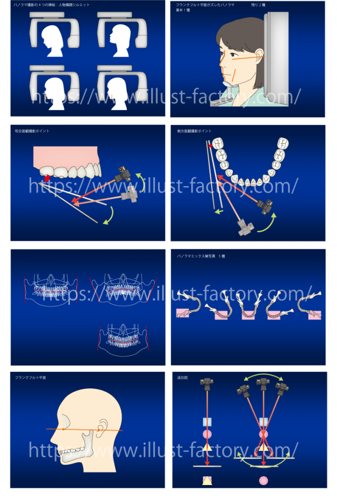 歯科医院様　歯の施術医療系イラスト　堅めの線画タッチ　H144