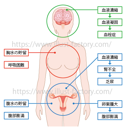 女性の人体イラスト　H232