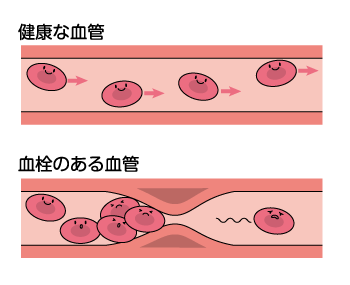 シンプルタッチ 説明用動画 図解イラスト制作 H44 イラスト工房