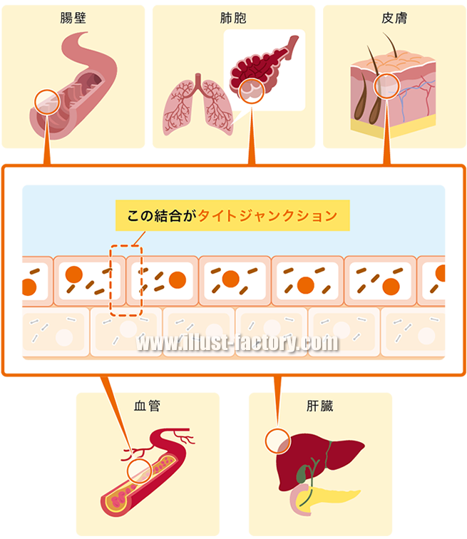 シンプルタッチ 医療向けイラスト 図解制作 H61 イラスト工房