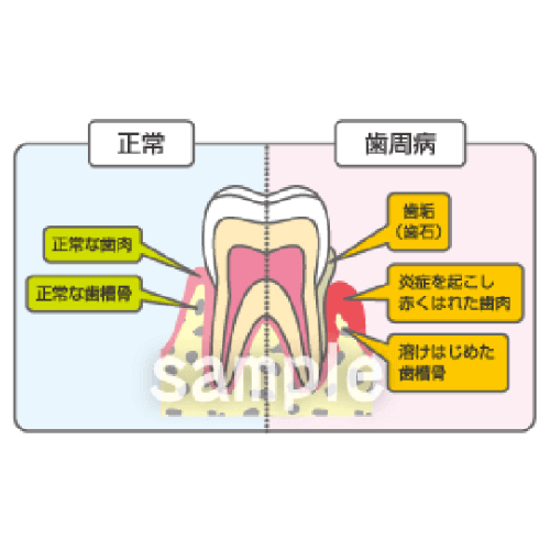 図解