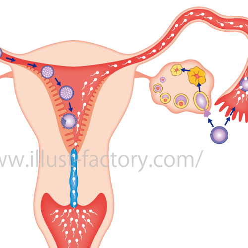 子宮イラスト　医療イラスト　医学論文 Figure デザイン　イラスト制作　イラスト工房　